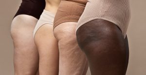 Jaki balsam na cellulit daje realne efekty? Sprawdź, na co naprawdę warto zwrócić uwagę
